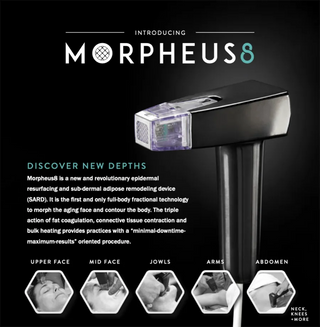 Morpheus 8 graphic shows that the device can be used on the upper face, mid-face, jowls, arms, and abdomen in a med spa in the Jacksonville, FL area.